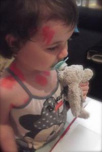 ma fille a la varicelle