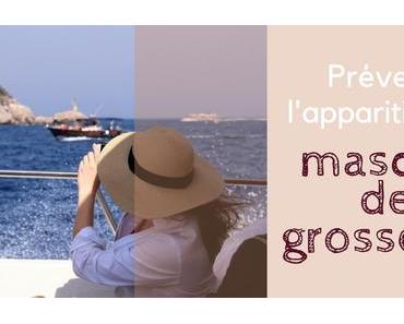 Masque de grossesse, prévenir son apparition.